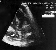 irm03.jpg (10770 bytes)